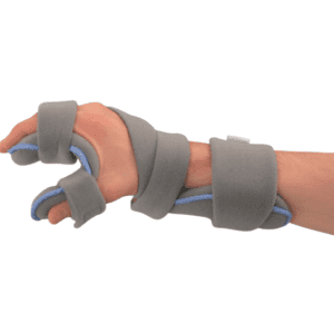 Ortótese Funcional de Mão